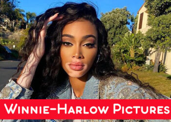 Winnie harlow photo gallery