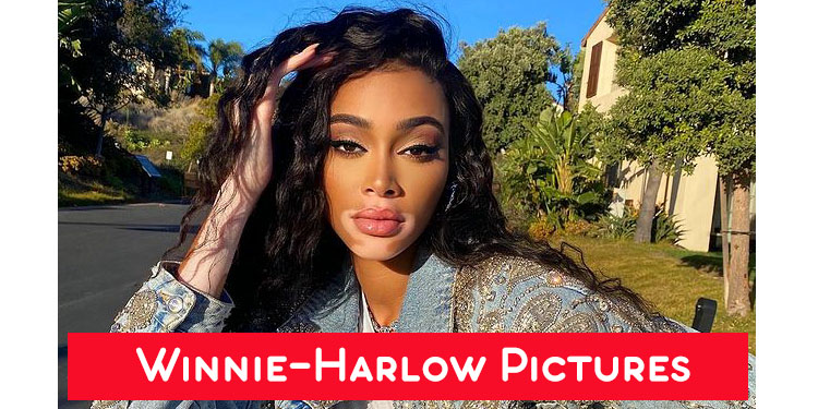 Winnie harlow photo gallery