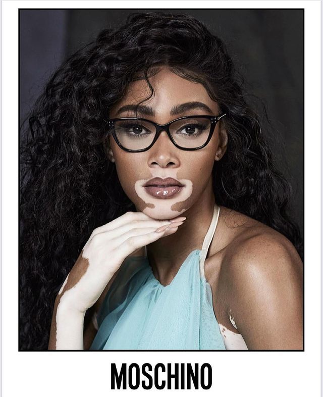 Winnie harlow wearing moschino glasses