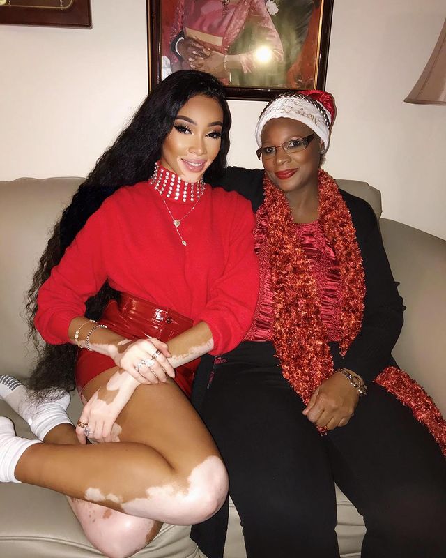 Winnie harlow with her mother